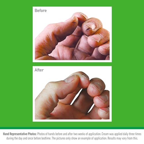 O’Keeffe’s Working Hands, 96g Jar - Hand Cream for Extremely Dry, Cracked Hands | Instantly Boosts Moisture Levels, Creates a Protective Layer & Prevents Moisture Loss O'Keeffe's