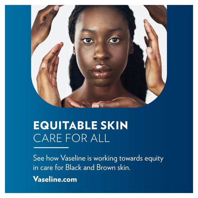 Vaseline Lip Therapy Original Lip Balm NORSONS